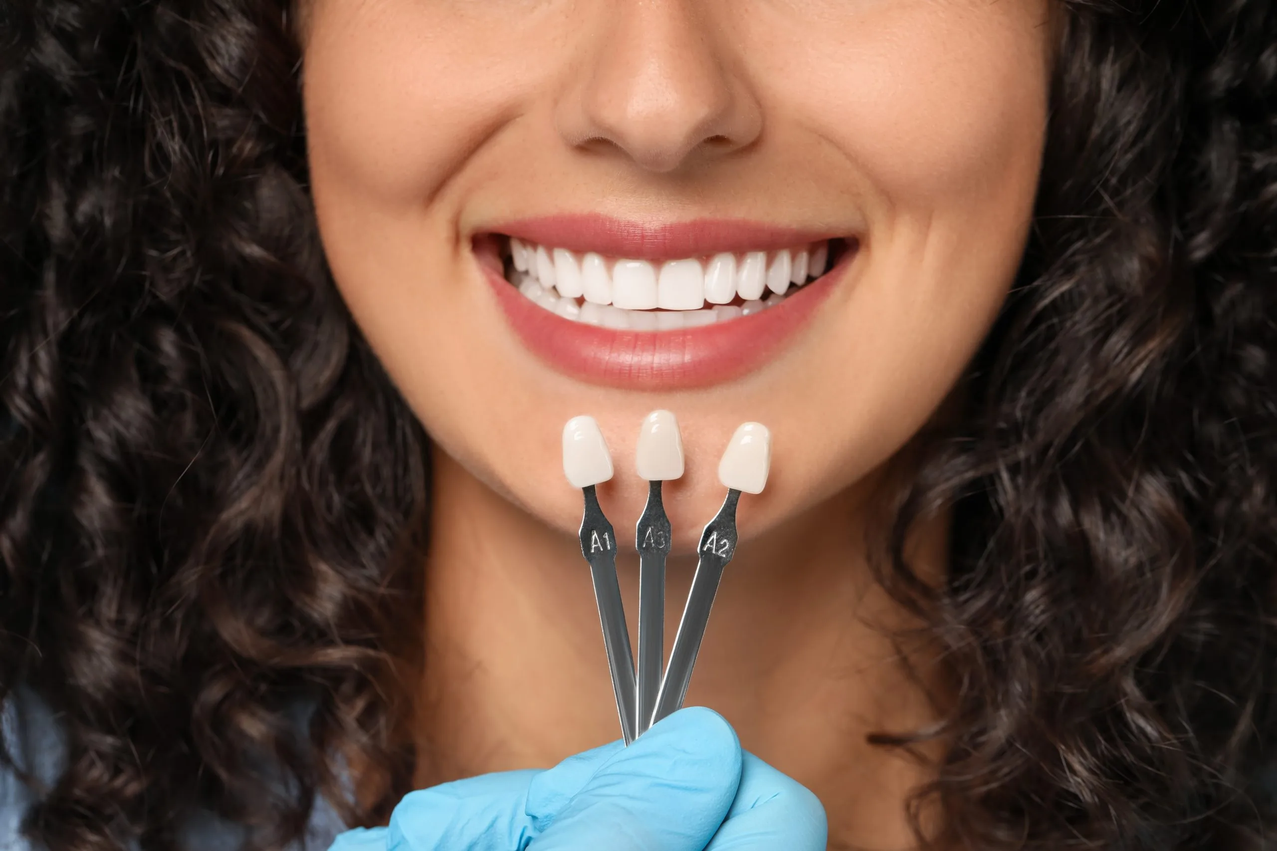 Woman with bright white smile holding three tooth shade comparison guides